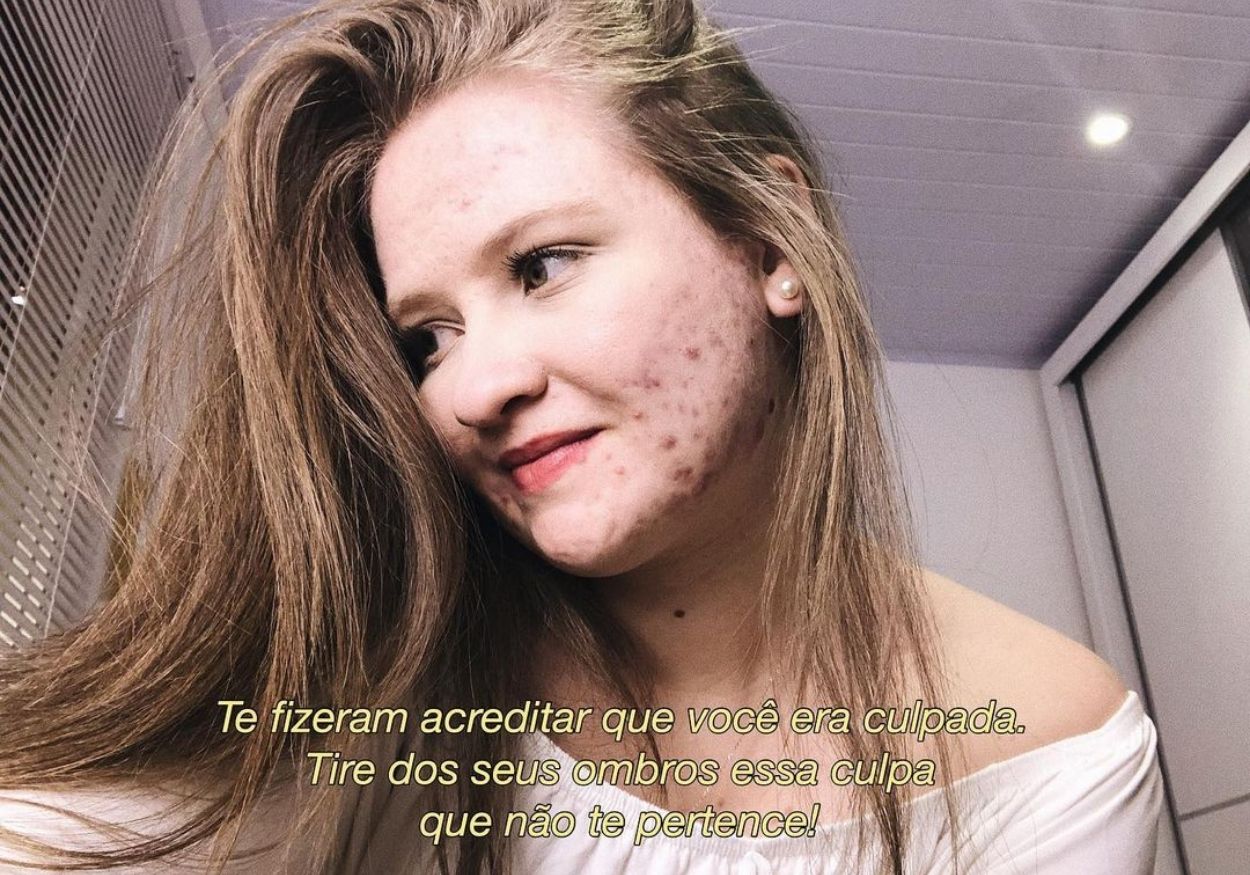 Pele livre: melhores influenciadoras do movimento skin positivity