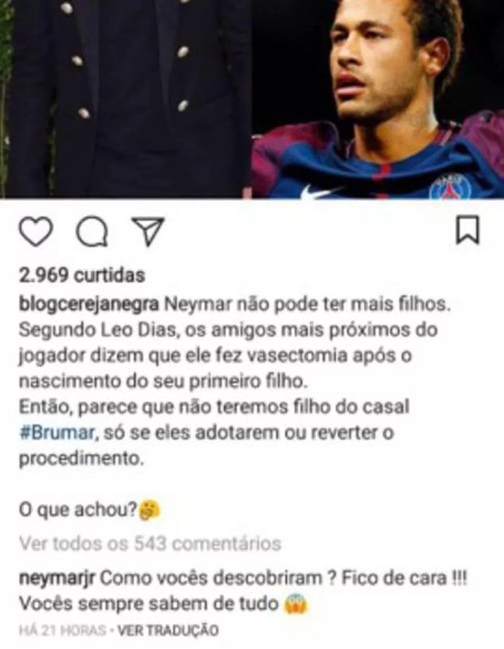 Neymar fez vasectomia