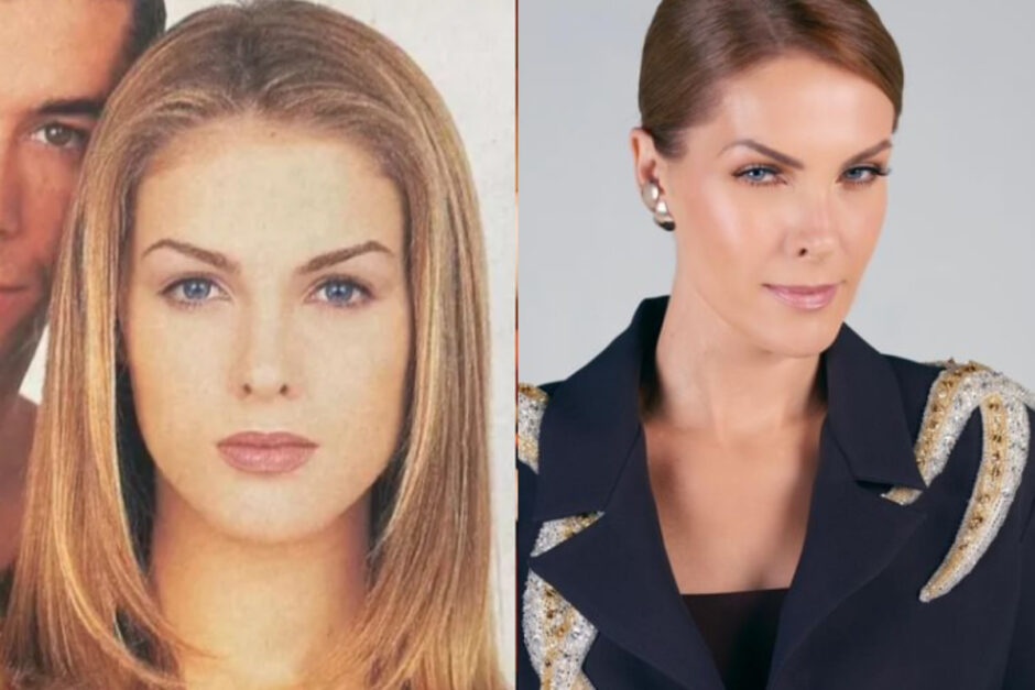 ana hickmann antes e depois