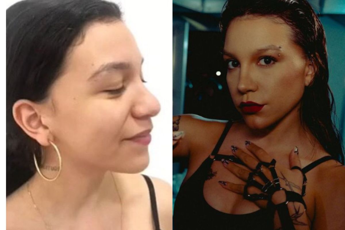 Antes e depois nariz